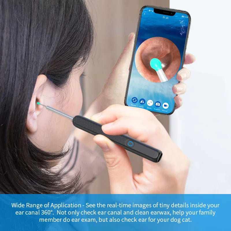 Nuwelo NE3 Ear Wax Removal Kit